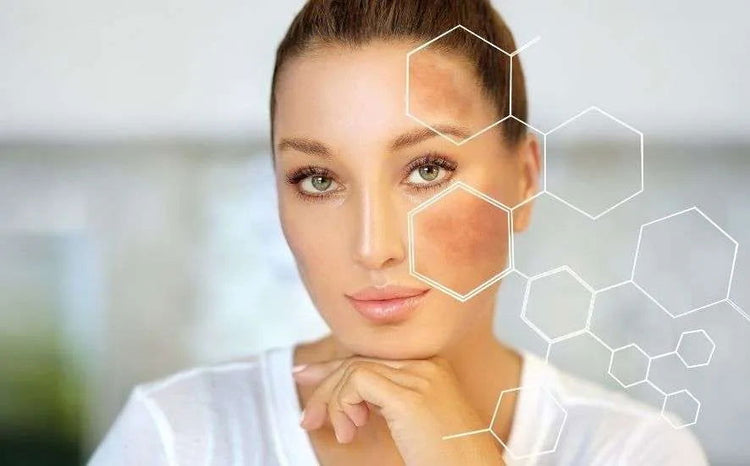 Pinky Cosmetics Skin Lightening Products collection focusing on reducing dark spots and enhancing skin tone.