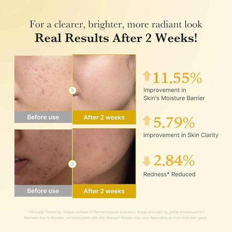 Medicube Kojic Acid Serum - Dark Spot Care - Serum - medicube -- United Arab Emirates -- Pinky Cosmetics