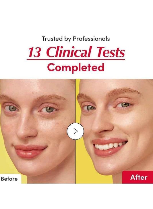 Vitamin Illuminating Serum - EQQUAL BERRY Deep Brightening - Serum - EQQUALBERRY -- United Arab Emirates -- Pinky Cosmetics