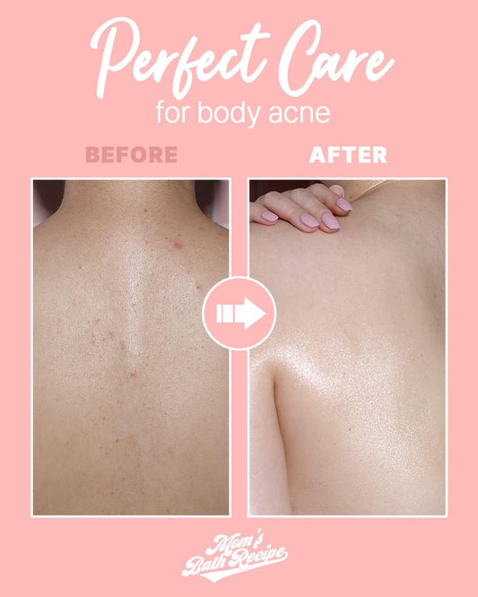 MOM’S BATH RECIPE PEELING PAD (TROUBLE CARE) - Pinky Cosmetics