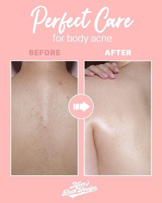 MOM’S BATH RECIPE PEELING PAD (TROUBLE CARE) - - Pinky Cosmetics -- United Arab Emirates -- Pinky Cosmetics