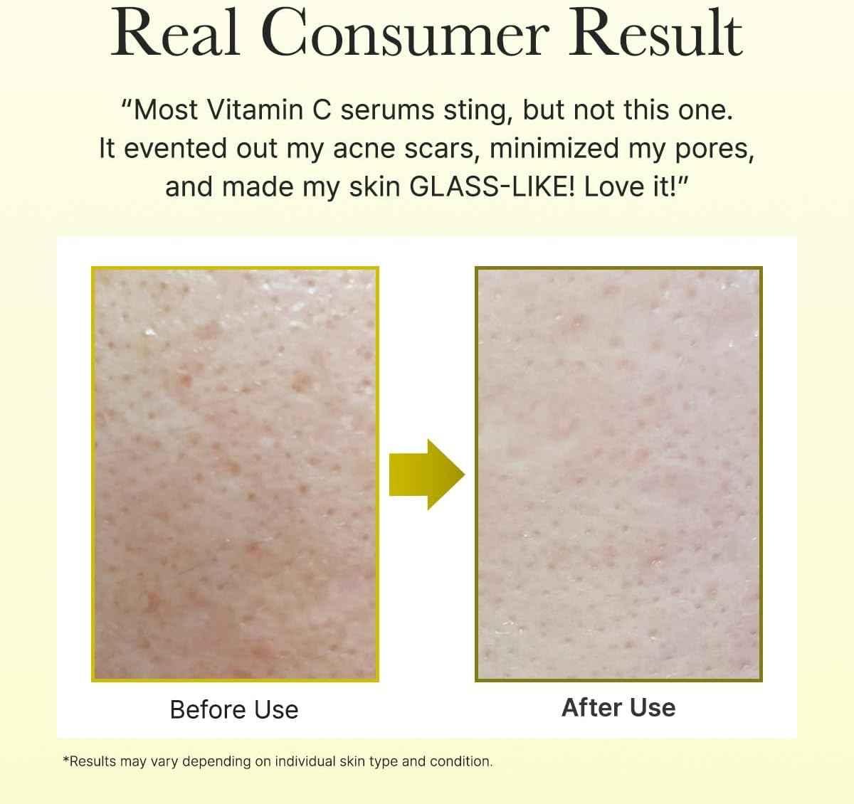 Vitamin C Eye Cream - Arencia Radiance Boost - Eye Cream - Arencia -- United Arab Emirates -- Pinky Cosmetics