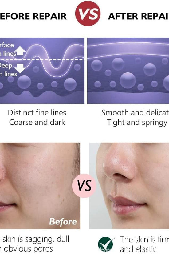 Comparison of skin appearance before and after using hydrating anti-aging skin cream 30g showing improved firmness and reduced fine lines