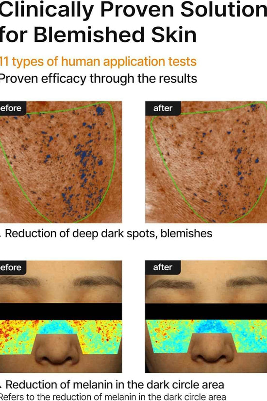 Celimax Pore + Dark Spot Brightening Cream – Radiant, Even Skin Daily Treatment - Skincare - Celimax -- United Arab Emirates -- Pinky Cosmetics