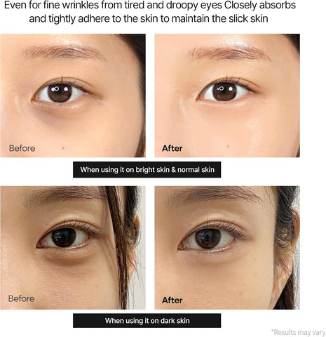 Dr.Melaxin Calcium Eye Cream - Dark Spot Cover 15g Dr.Melaxin Eye Cream  Pinky Cosmetics