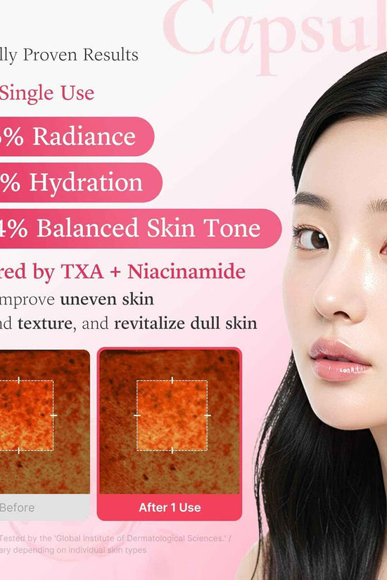 Medicube TXA Niacinamide 5% Capsule Cream - Brightening & Dark Spot Treatment 55g