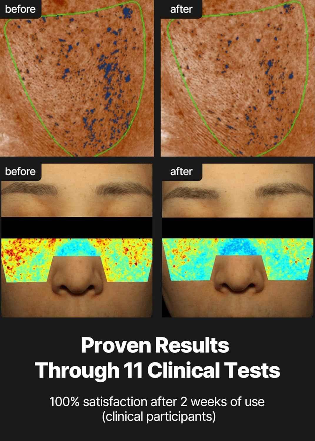 Celimax Pore + Dark Spot Brightening Cream – Radiant, Even Skin Daily Treatment - Skincare - Celimax -- United Arab Emirates -- Pinky Cosmetics