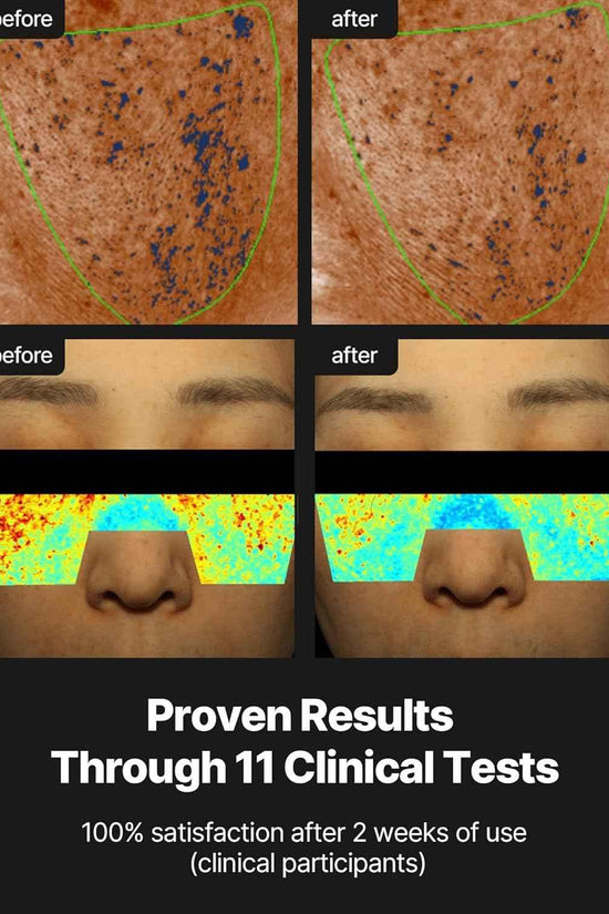 Celimax Pore + Dark Spot Brightening Cream – Radiant, Even Skin Daily Treatment - Skincare - Celimax -- United Arab Emirates -- Pinky Cosmetics