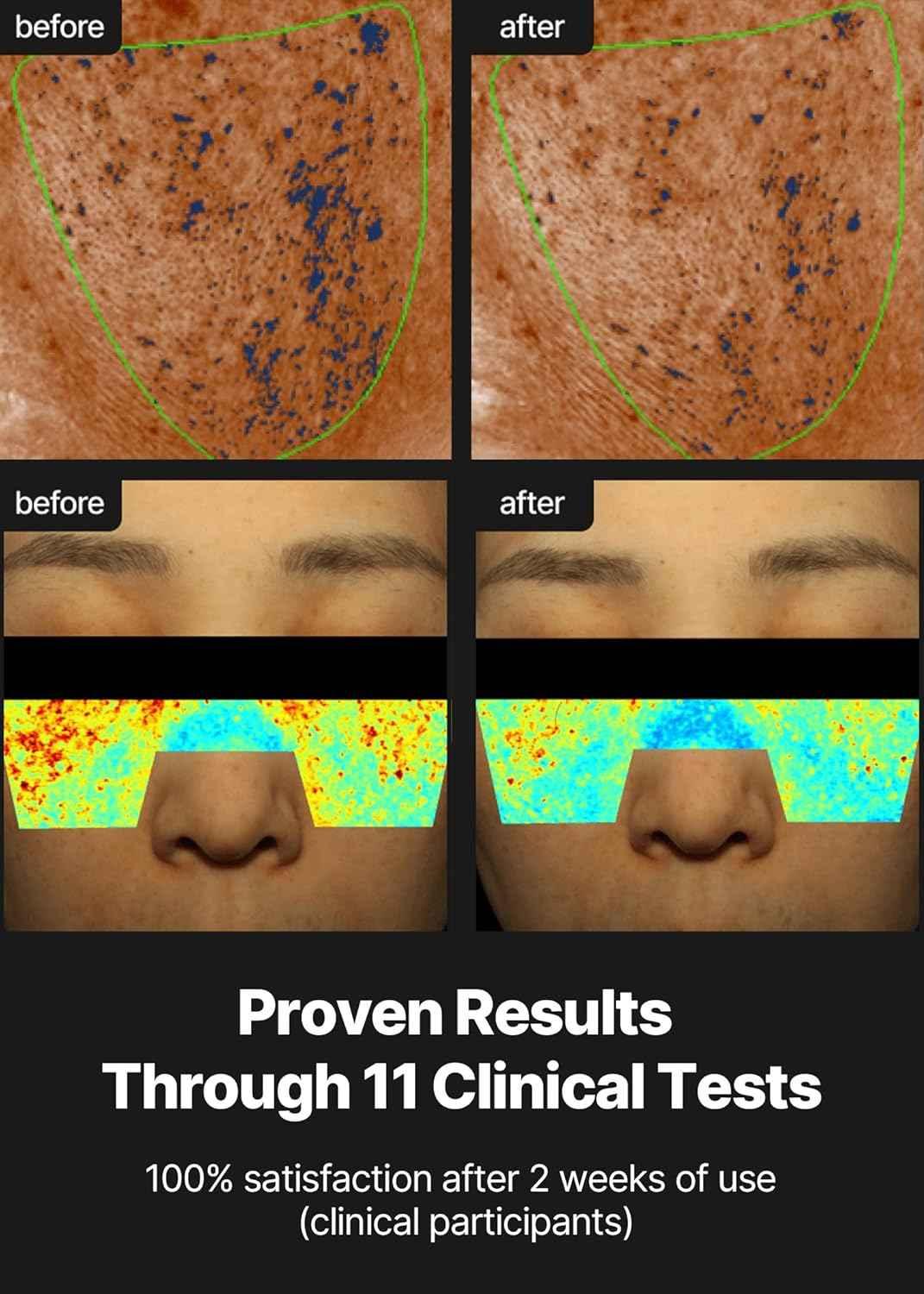 Celimax Pore + Dark Spot Brightening Cream – Radiant, Even Skin Daily Treatment - Skincare - Celimax -- United Arab Emirates -- Pinky Cosmetics