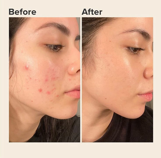 AXIS-Y Dark Spot Correcting Glow Serum - Pinky Cosmetics