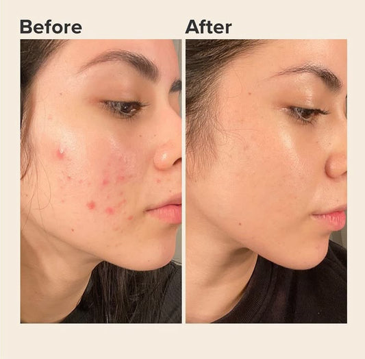 AXIS-Y Dark Spot Correcting Glow Serum - Pinky Cosmetics