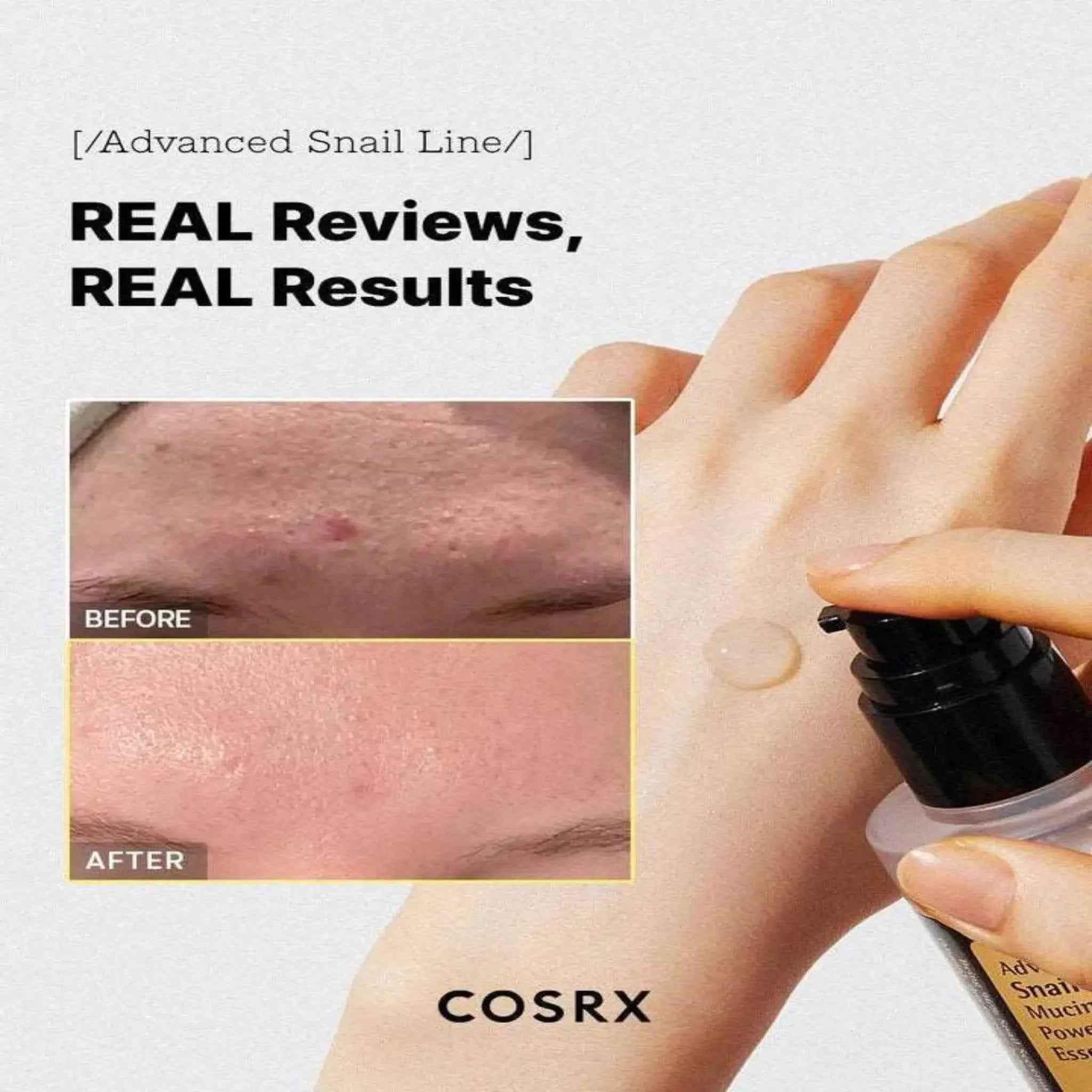 COSRX Advanced Snail 96 Mucin Power Essence – 100ml - All-in-One Moisturizing Cream - COSRX -- United Arab Emirates -- Pinky Cosmetics