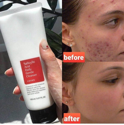 Oily & Acne-Prone Skin Routine Set – 4-Step Skincare Kit - Skincare Set - Dr. Araby, The Ordinary, COSRX -- United Arab Emirates -- Pinky Cosmetics