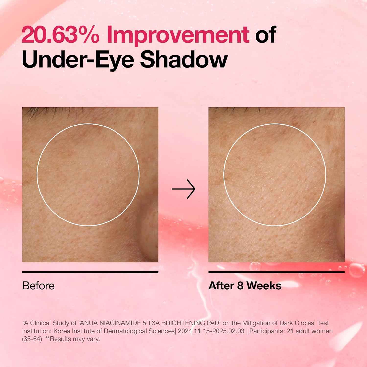 Anua Brightening Pad - Niacinamide 5% TXA Glow Booster