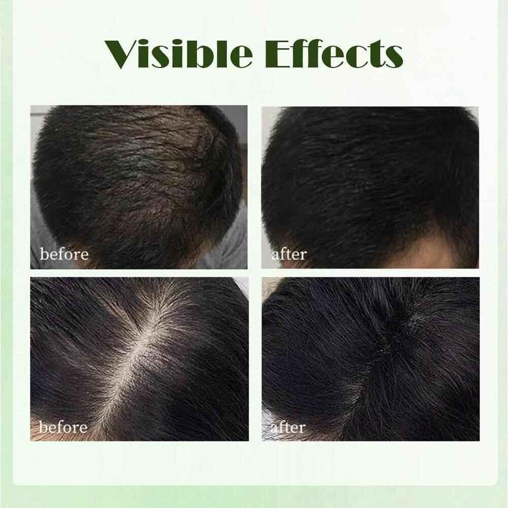 Seven Green Shampoo Bar - Nature Triangle Hair Care - Shampoo Bar - Nature Seven -- United Arab Emirates -- Pinky Cosmetics