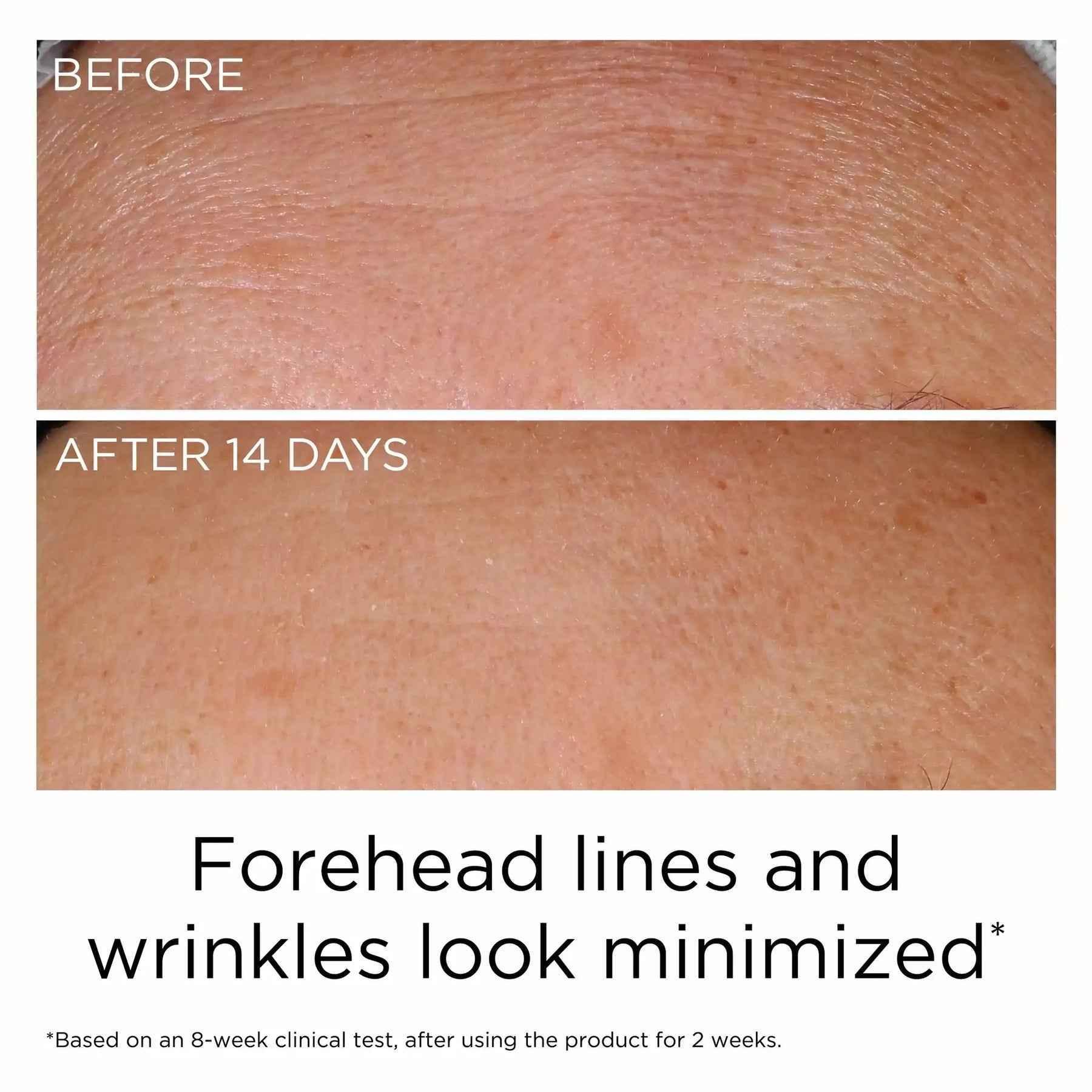 Prevage Anti Aging Serum - Elizabeth Arden 2.0 Formula - Serum - Elizabeth Arden -- United Arab Emirates -- Pinky Cosmetics